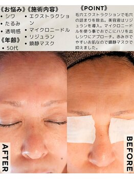 サロン ザ プマロ(SalonThePumalo)/シワ＆ハリup