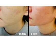 サロンモコ(Salon Moco)の雰囲気（頭皮ケア/髪質改善/体の痛み/肩こり/肩甲骨/たるみ/シワ）