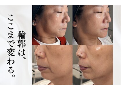 メルト 中目黒(Melt.)の写真