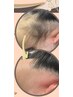 効果抜群! 女性 うなじ(Wax +光ダブル脱毛)¥7000→¥6800