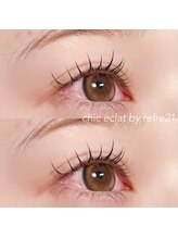 シックエクラ バイ リフレ21(chic eclat by Refre21)/ラッシュリフト（まつ毛パーマ）