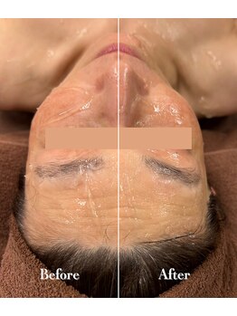 ノンノン(NonNon)/瞬間シャープ顔