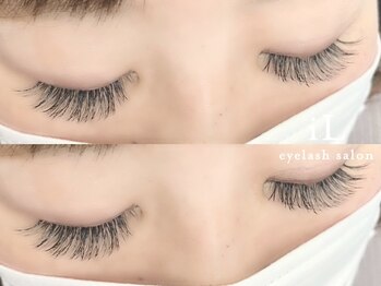 イル(iL)/バインドロック♪　☆大澤