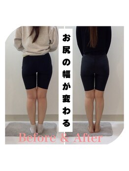 スタイルラボ高松/骨盤矯正の効果♪