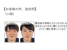 江坂回復アップラボ/お客様の声、施術例