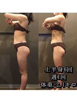 カルム エ コンポーゼ(Calme et Compose')/痩身セルゼロ/上半身6回