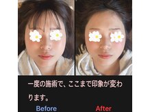 美容矯正サロン レレポノ(LELEPONO)