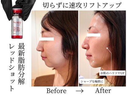 40代からの肌管理サロンB’S STYLE 【美肌育成／毛穴洗浄／たるみケア】の写真