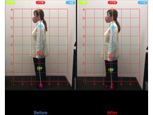 ケアルーム 湘南台(CARE room)/施術効果写真☆（before after）