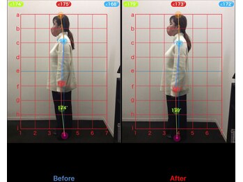ケアルーム 湘南台(CARE room)/施術効果写真☆(before after)