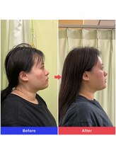 整音(totonone)/フェイスライン・首の細さ