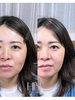 エントワ(ENTOWA)/左右差がある眉も