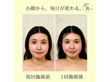 ラヴィの写真