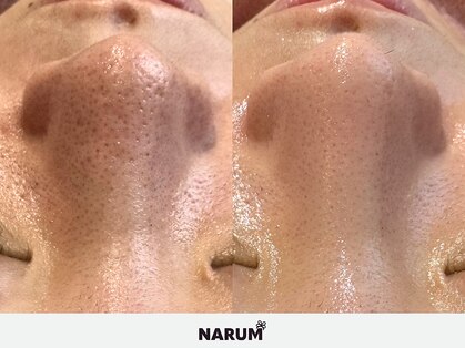 ナルムフェイシャル 代々木(NARUM facial)の写真