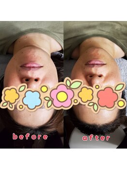 サンイチゼロ(310)/before→after