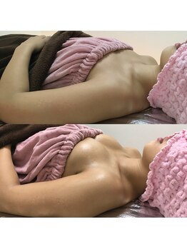 ヴィーナス(Venus)/バストアップ(痩身効果◎整体◎