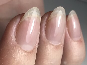 カーリーネイル 豊見城 那覇店(carlynail)/美しいベース/フォルム形成