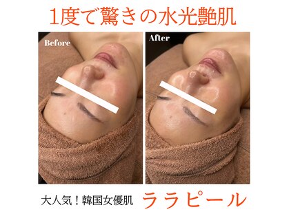 アリュールビューティー 下高井戸店(ALLURE BEAUTY)の写真