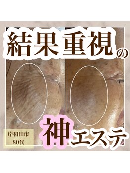 ミュウ(miuex)/結果重視！！