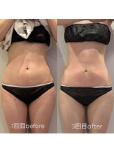 ウィール 栄 矢場町店(WE:LL)/ウエスト集中