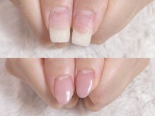 グラシナ 鳥丸店/深爪　育爪の為のオイル