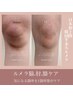 【ルメラメ選べる1部位】ワキ/ひじ/ひざの黒ずみケアに ¥98000→¥57900