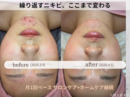 リボーン(Reborn)の写真