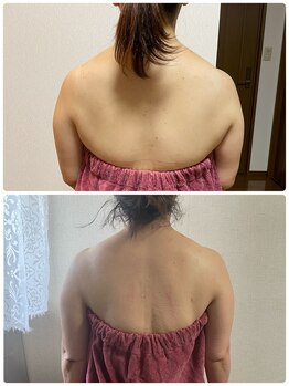 ブリランテ(Brillante)/体験→継続6回目beforeafter