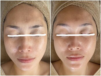 メイン(main)/★before after★