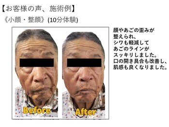 江坂回復アップラボ/お客様の声、施術例