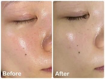 ケー(K)/ホワイトピーリング