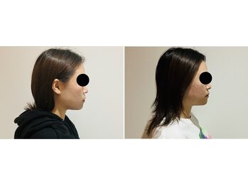 トゥジュール(Toujours)/骨格矯正美顔コース(さつま式)