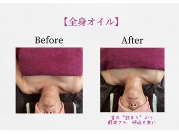 ハナコ by ほぐしの名人 弁天インター店(HANAKO)/