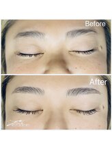 フェリーチェ(Felice)/ハリウッドブロウリフト