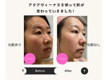 ボディトーン(bodytone)/無添加コスメ使用フェイシャル