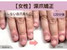 【再発させない深爪矯正】女性ハンド/栃木県初！自爪風◎即日見た目改善