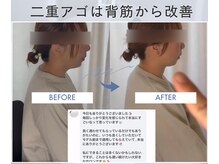 エイトヒーリング(8Healing)の雰囲気（体重は変わらないのにアゴ肉が…骨格を変えて一撃で改善。）