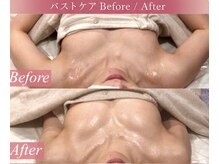ローズドゥシャロン(Rose de CHALON)の雰囲気(【ぷるふわ美バスト】最新機器プラズマ×微弱電流でハリ弾力UP★)