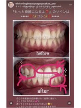 ホワイトニングビューティー 名古屋栄店(WHITENING BEAUTY)/セルフホワイトニング