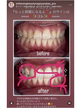 ホワイトニングビューティー 名古屋栄店(WHITENING BEAUTY)/セルフホワイトニング