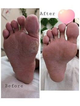 リゼラアンドコー 旭川店/before　after