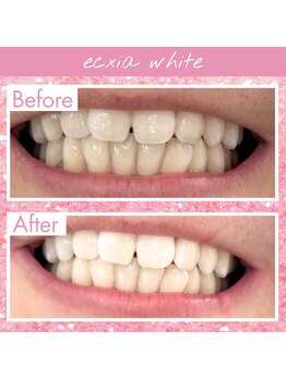 エクシアホワイト 倉吉店(ecxia white)/ビフォーアフター