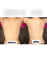 モルティー 宇都宮東店(Molti)&nbsp;筋膜 EMS