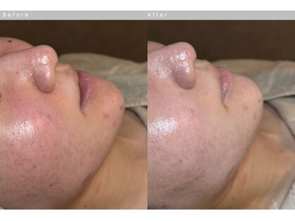 ルーツリー(Rootree)の写真