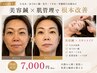 | たるみ根本改善・エンジングケア | 電気美容鍼+水光肌パック+カッサ付60分