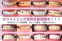 エクシアホワイトニング 熊谷店