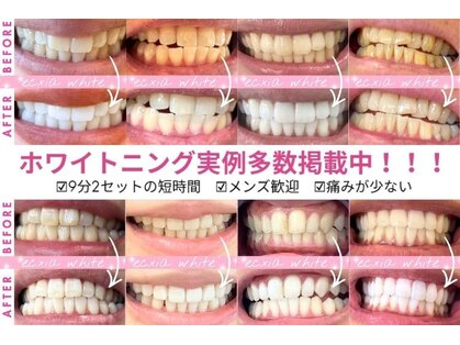 エクシアホワイトニング 熊谷店の写真