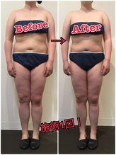 オージャス(OJAS)/40代○○さんの変化　痩ボディへ