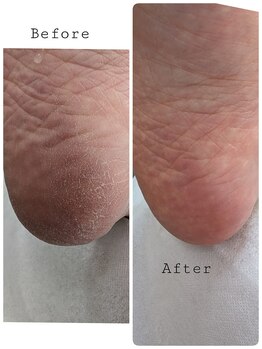 リゼラアンドコー 旭川店/before　after