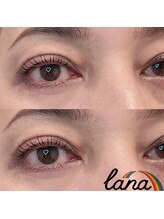 ラナ(lana)/パリジェンヌラッシュリフト